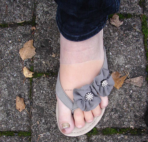 Zehenprothesen_donned_in_Schuh_kleiner.JPG  