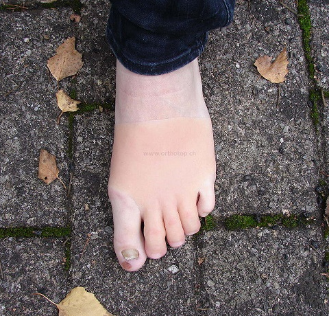 Zehenprothesen_donned_kleiner.JPG  