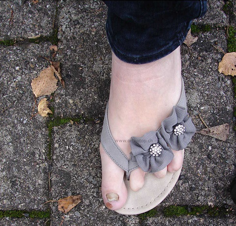 Zehenstümpfe_in_Schuh_kleiner.JPG  