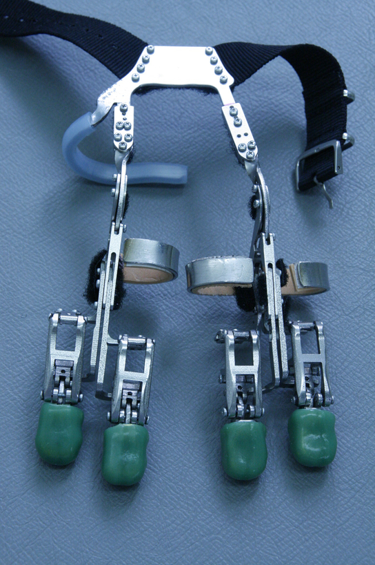 Mechanische Prothesen für Finger  