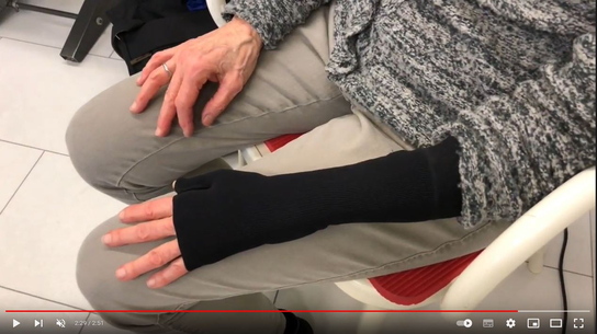 Thumbnail_Video_Kompressionshandschuh_zur_Narbentherapie.JPG  