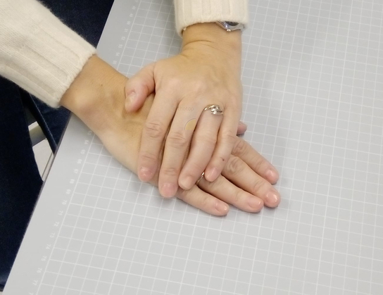 2019_Ringfinger_Prothese_innen__3_.jpeg  