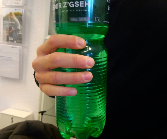 2019_Kleinfinger_definitive_Prothese__2_.jpg  
