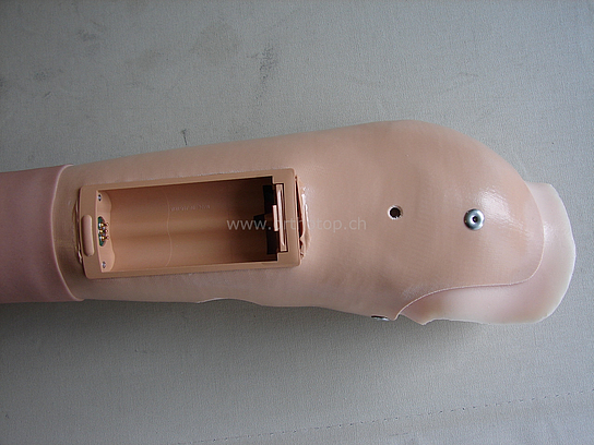 Armprothese_Schaftwechsel__2__prot.JPG  