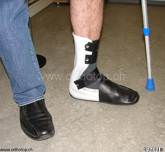 Orthese_nach_Fersenbeinbruch.jpg  