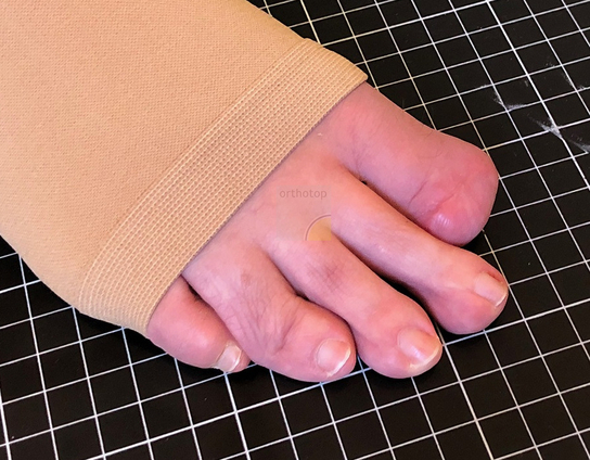 Amputation_D1__3_.JPG  