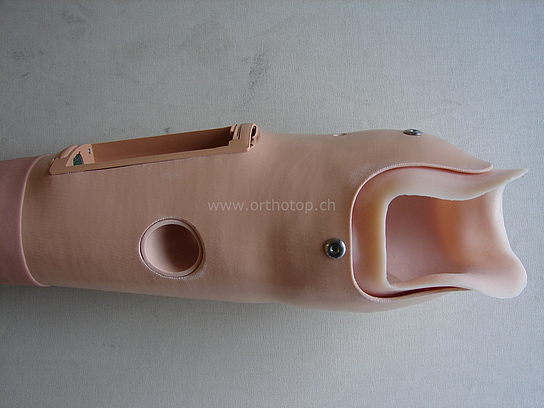 Armprothese_Schaftwechsel__3__prot.JPG  
