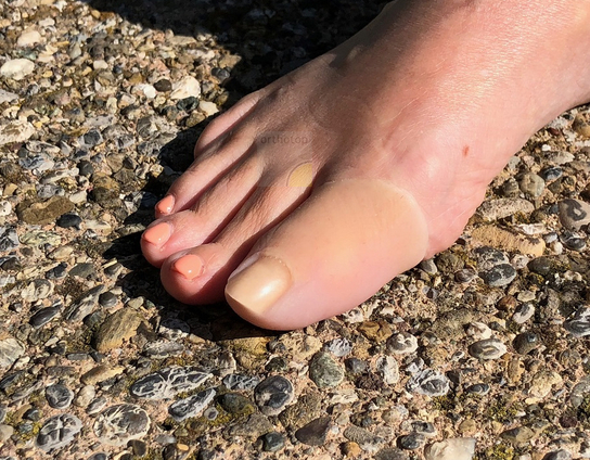 Zehenprothese_D1__4_.JPG  